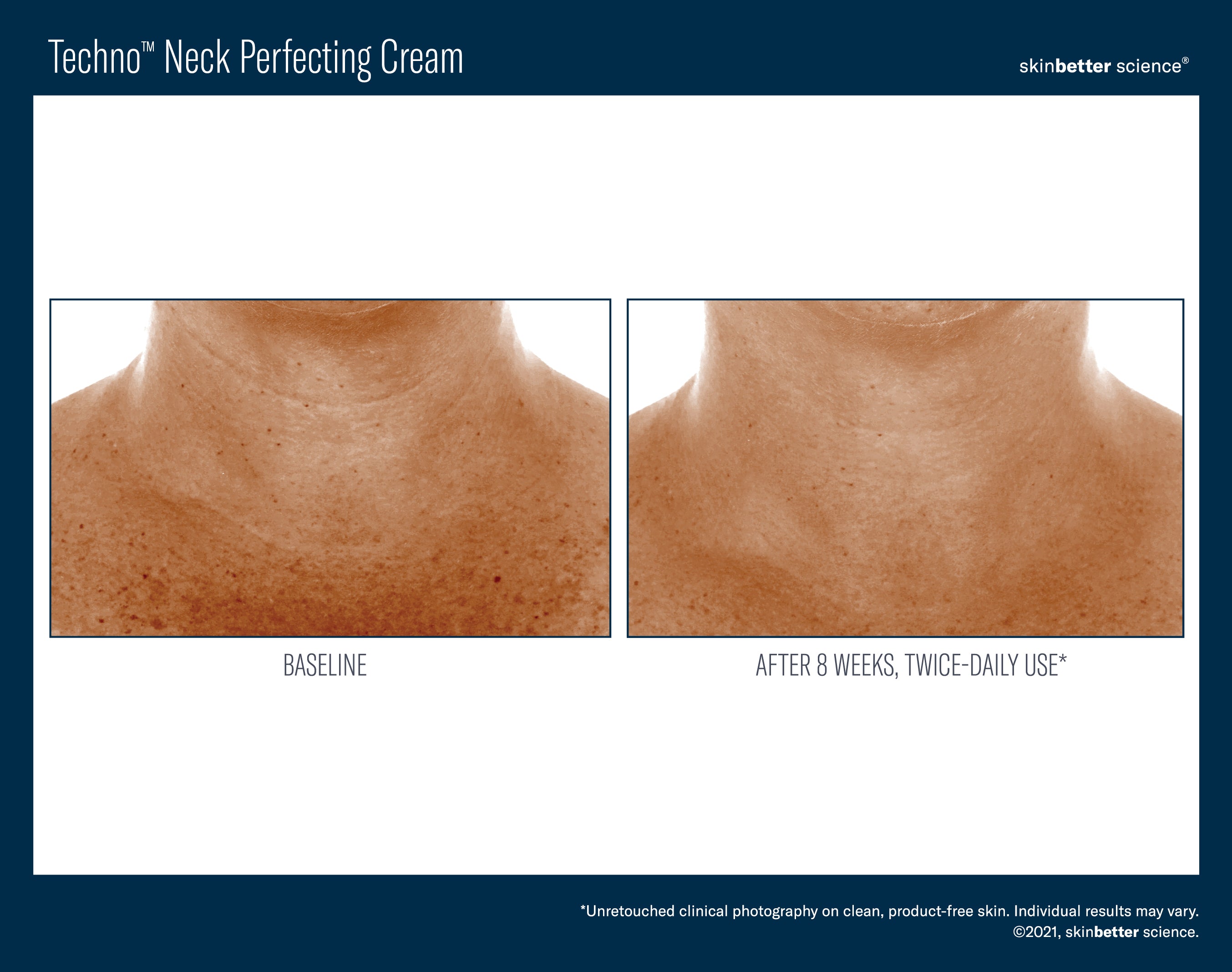 SkinBetter Science Travel Size Techno Neck Perfecting Cream (0.5 oz).