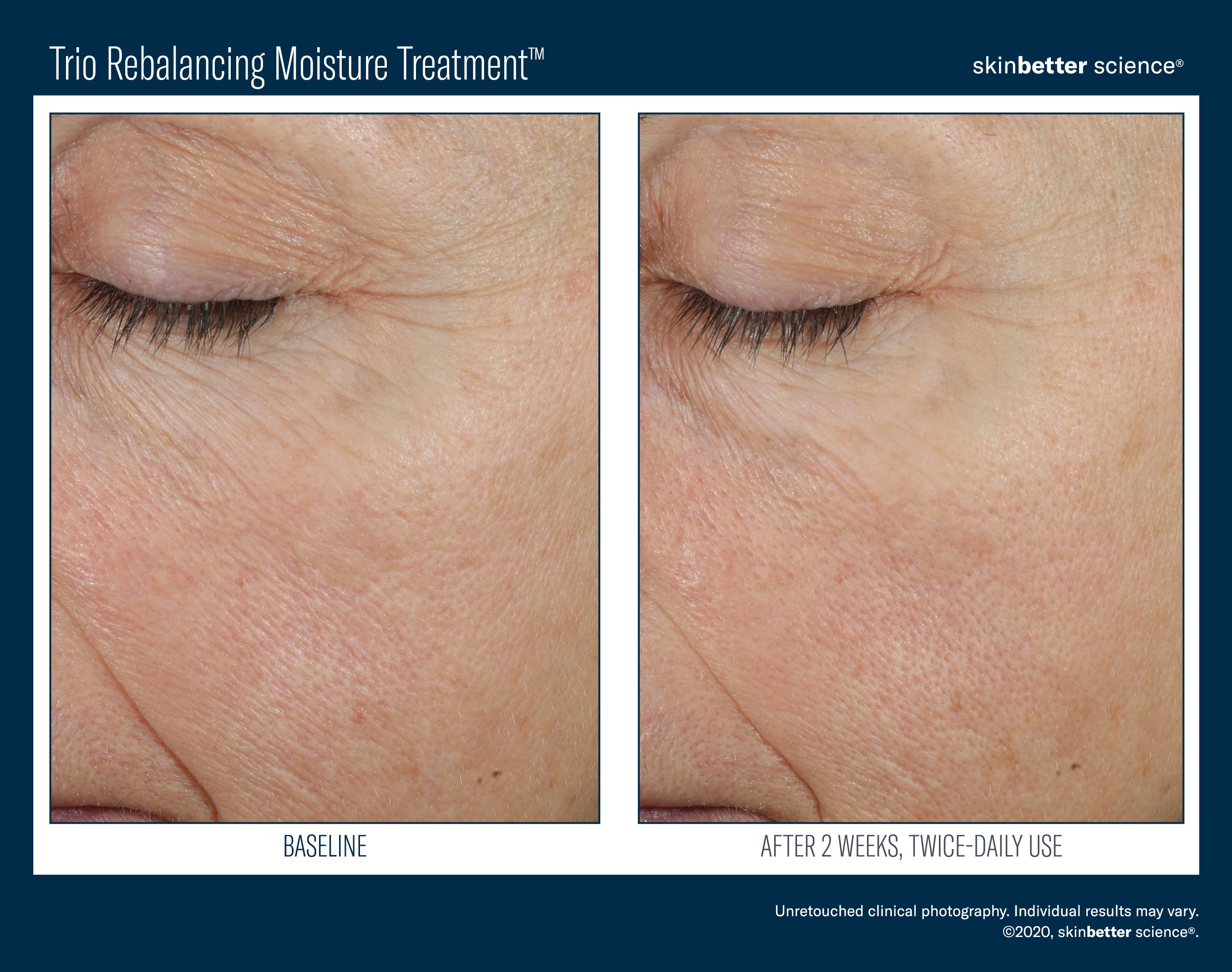 SkinBetter Science Travel Size Trio Rebalancing Moisture Treatment (0.5 oz).
