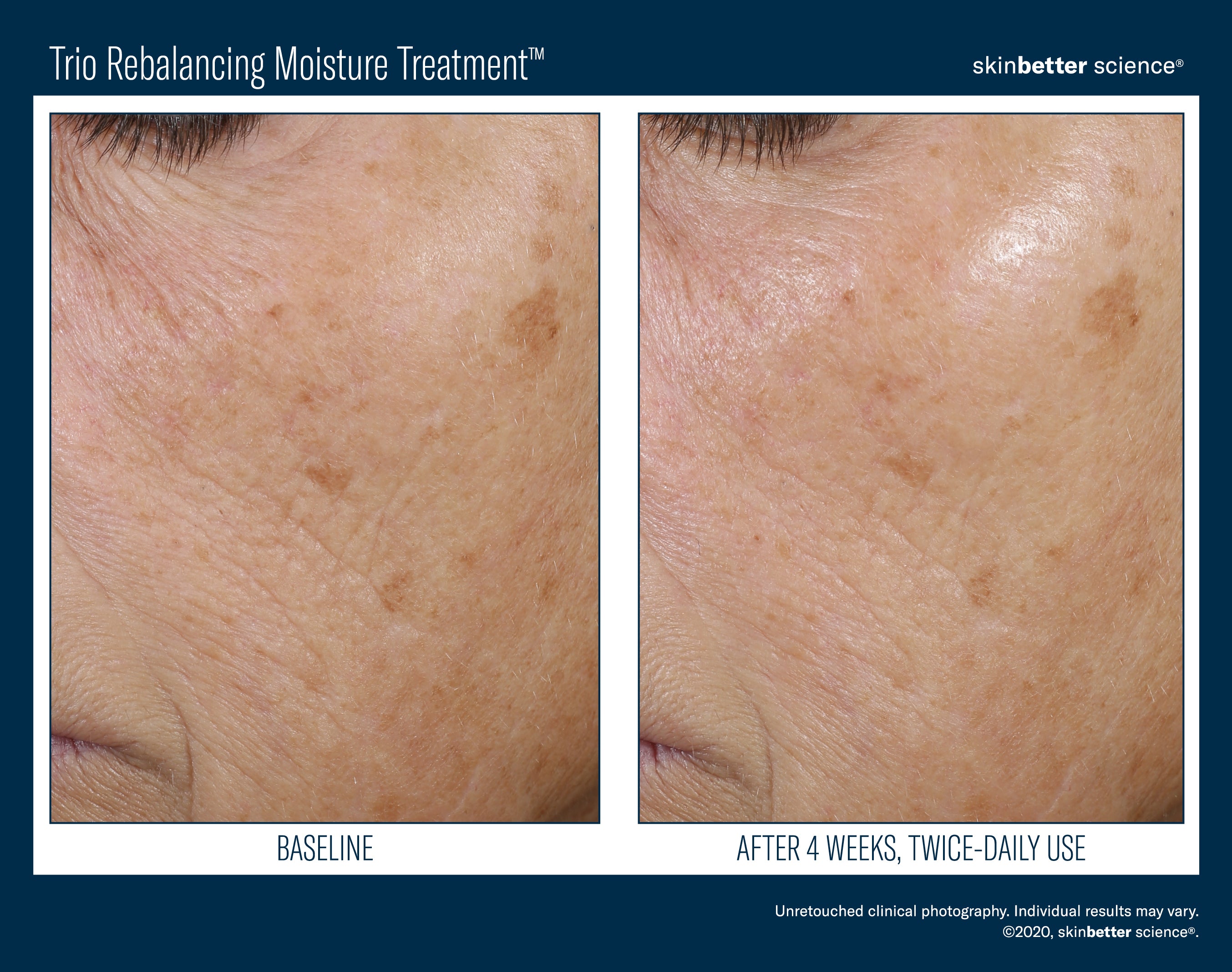 SkinBetter Science Travel Size Trio Rebalancing Moisture Treatment (0.5 oz).