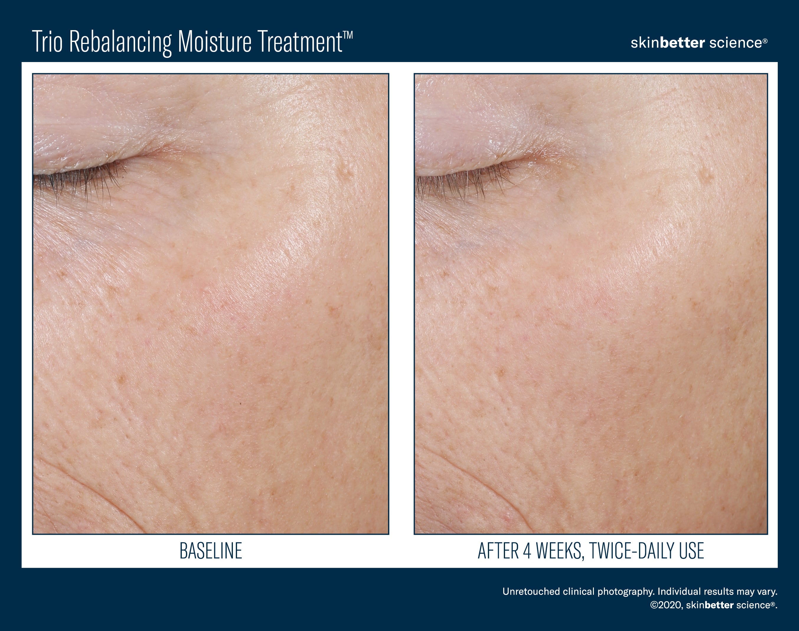 SkinBetter Science Trio Rebalancing Moisture Treatment (1.69 oz).
