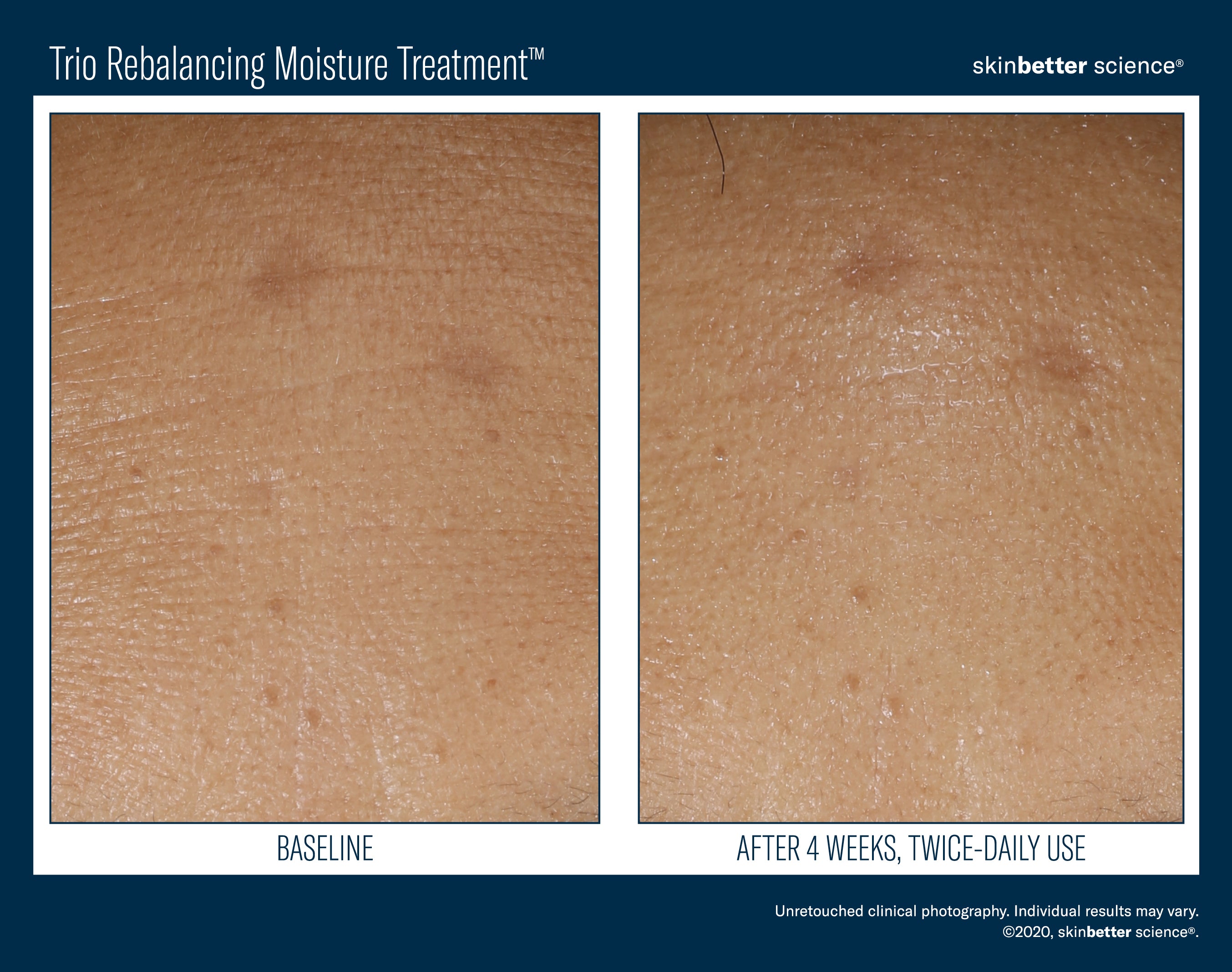 SkinBetter Science Travel Size Trio Rebalancing Moisture Treatment (0.5 oz).