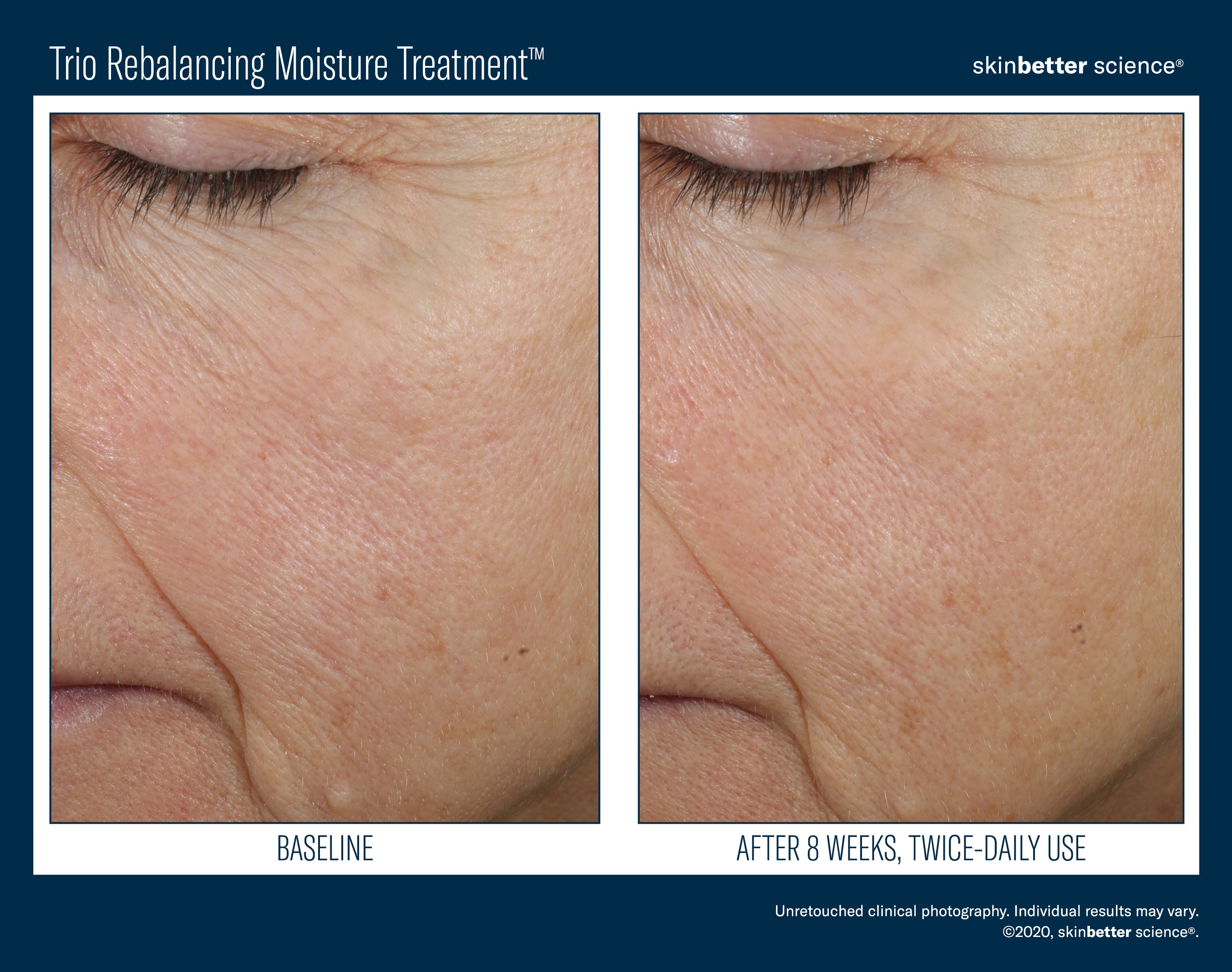 SkinBetter Science Travel Size Trio Rebalancing Moisture Treatment (0.5 oz).
