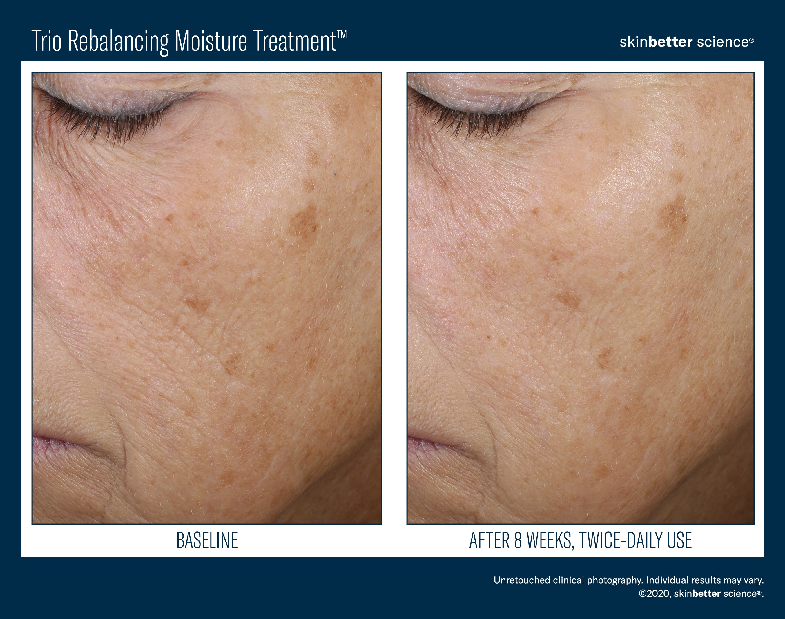 SkinBetter Science Trio Rebalancing Moisture Treatment (1.69 oz).