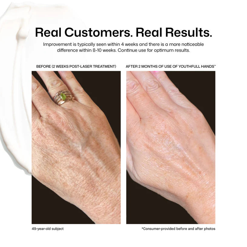 Revision Skincare YouthFull Hands (1.7 oz).