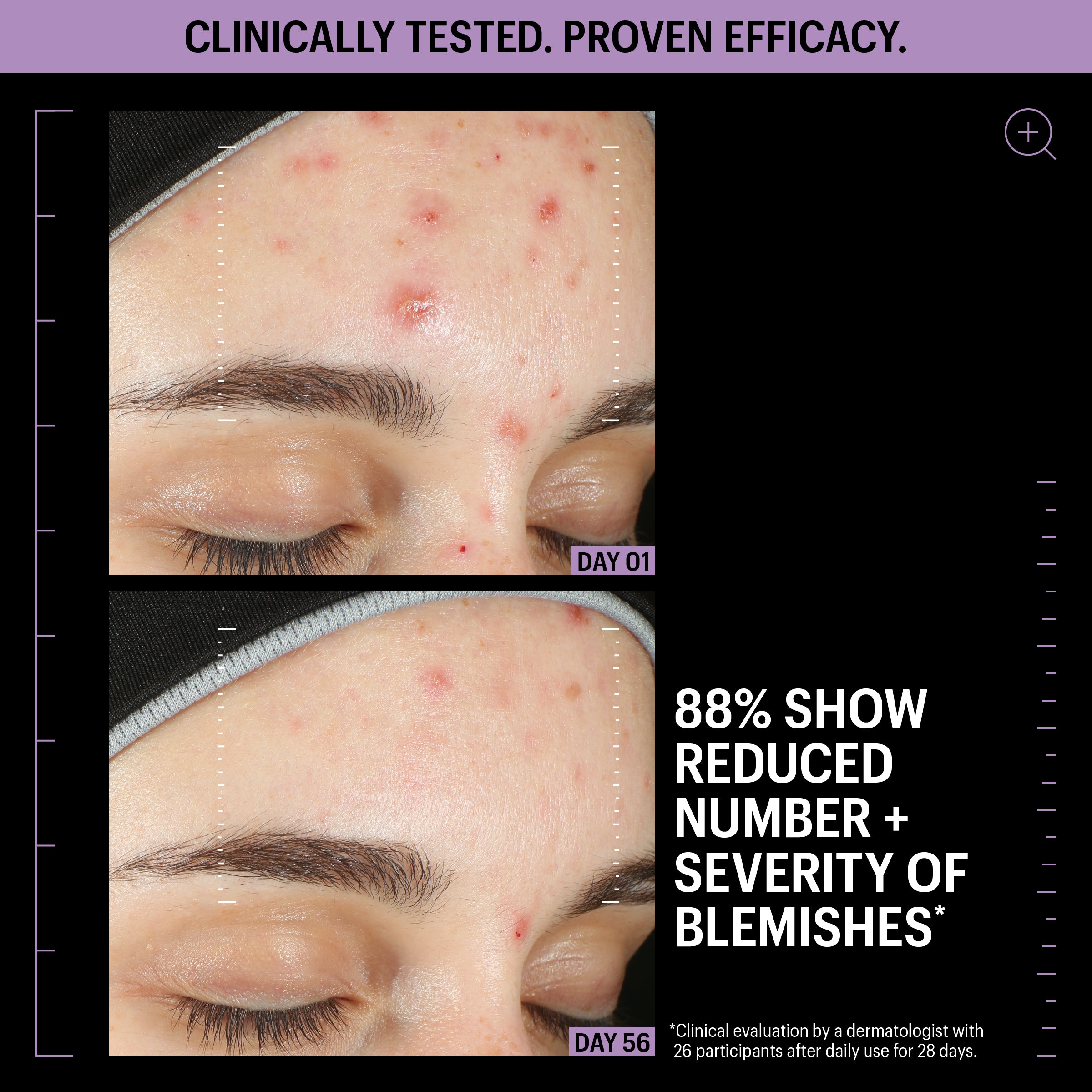 Allies of Skin Azelaic and Kojic Advanced Clarifying Serum (1 oz).