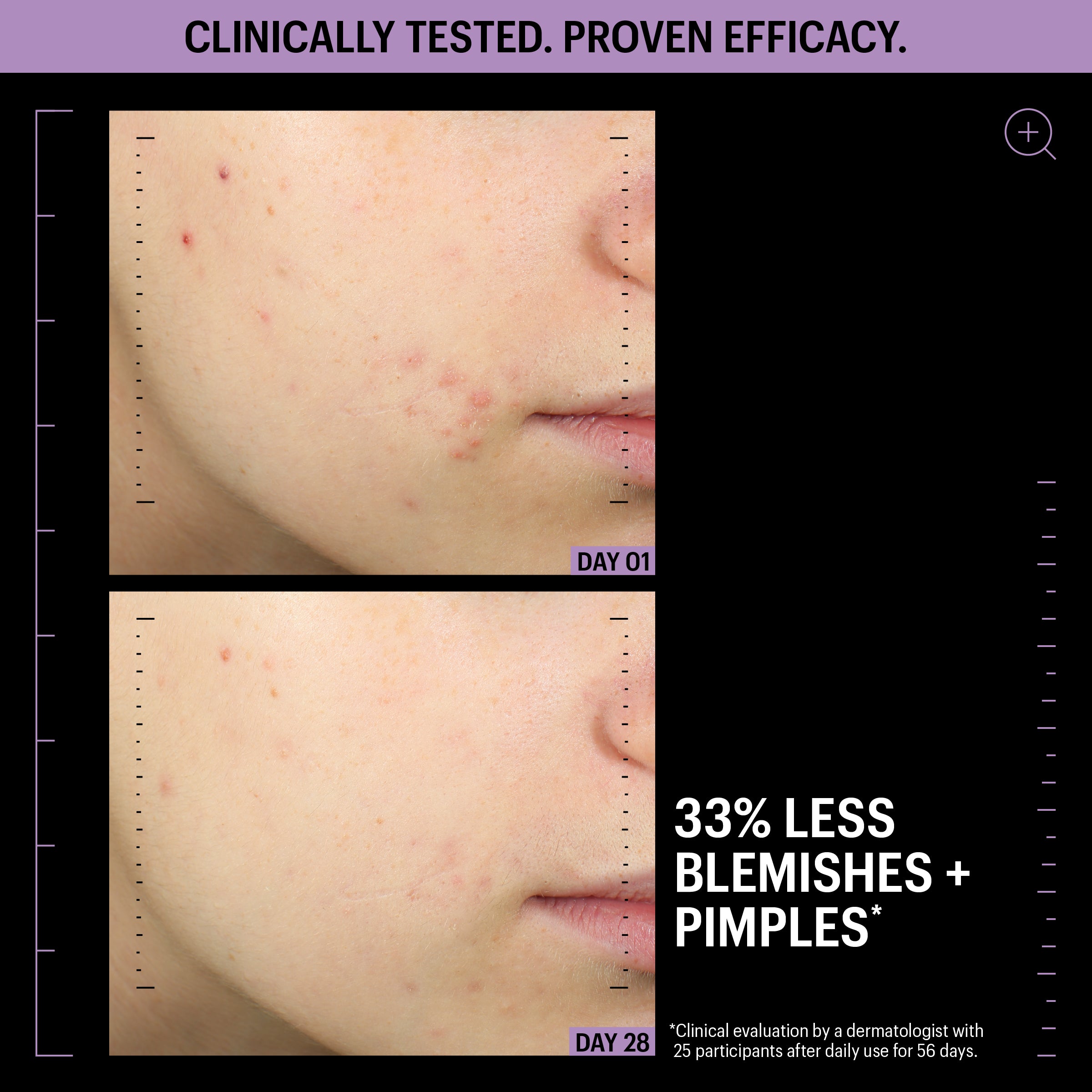 Allies of Skin Azelaic and Kojic Advanced Clarifying Serum (1 oz).