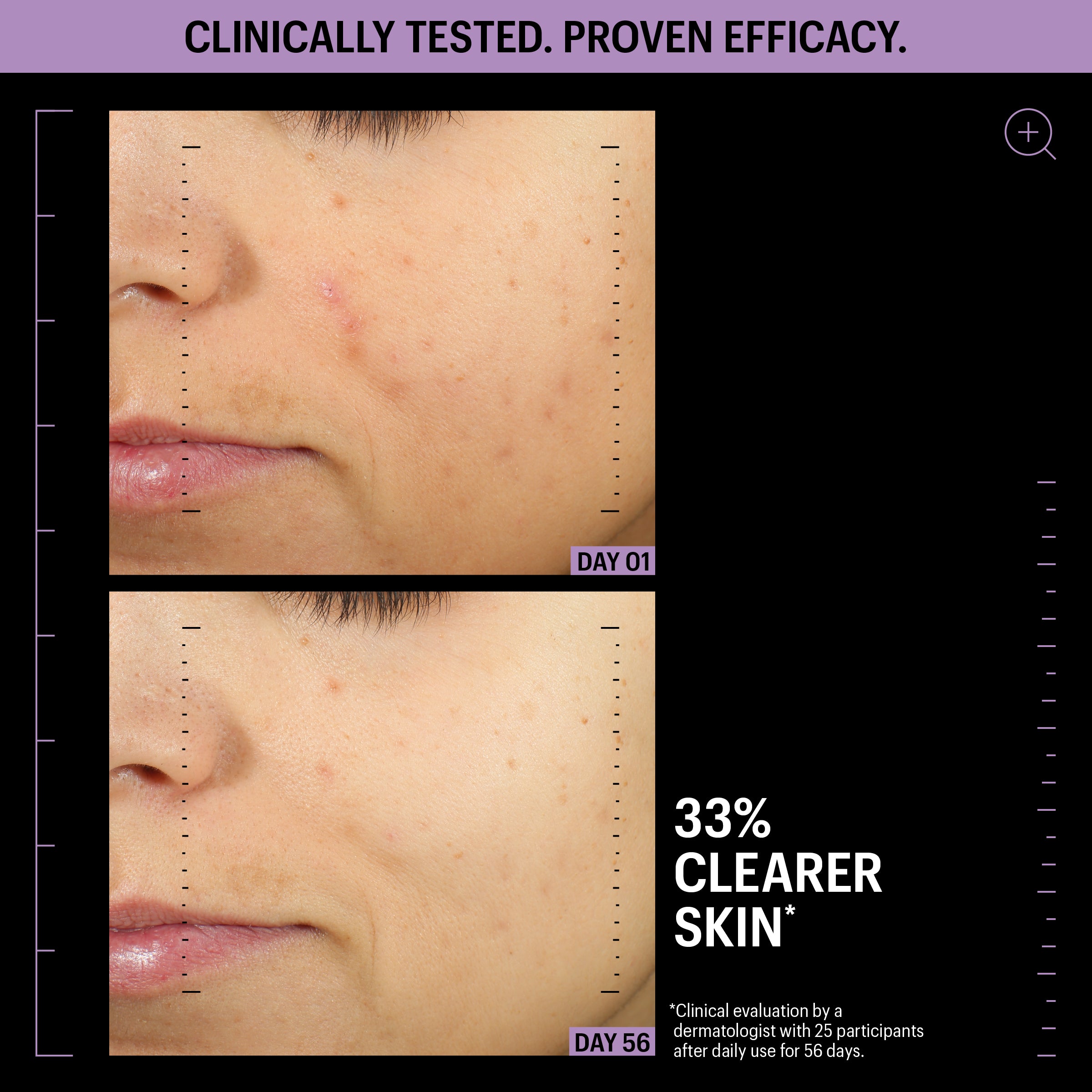 Allies of Skin Azelaic and Kojic Advanced Clarifying Serum (1 oz).
