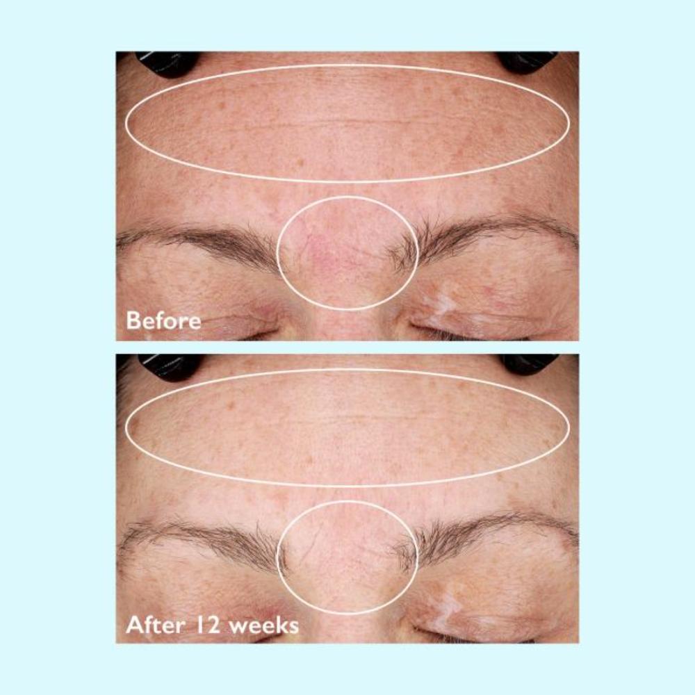 Restorsea Rejuvenating Day Cream with Vibransea Complex (1.7 oz).