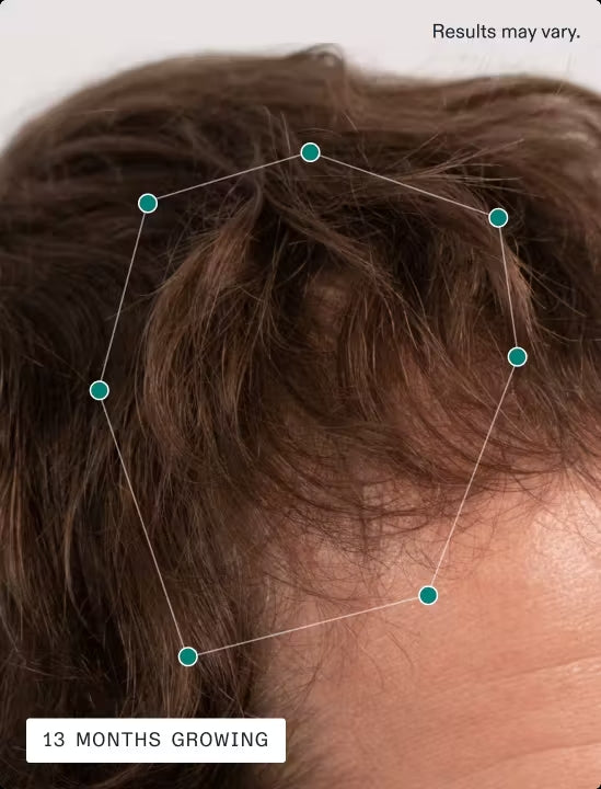 Nutrafol Men's Hair Growth Nutraceutical (120 Capsules).