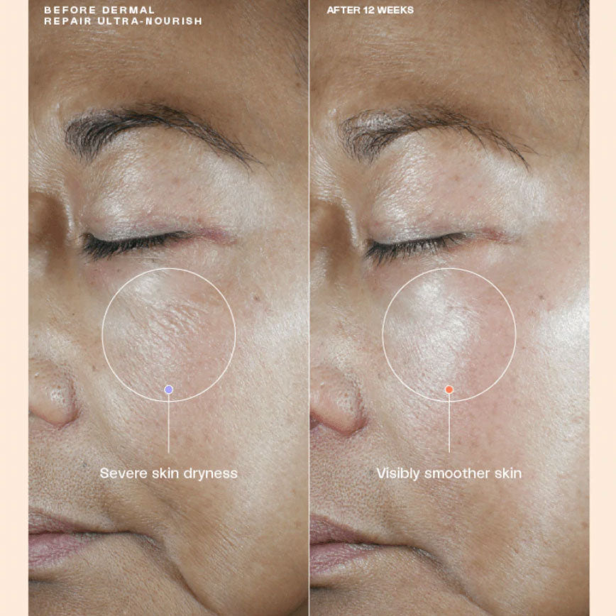 Senté Dermal Repair Ultra-Nourish (1.7 oz)